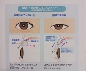 アップニーク始めました